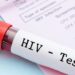 Mengungkap 4 Mitos Keliru Seputar HIV yang Membahayakan Masyarakat